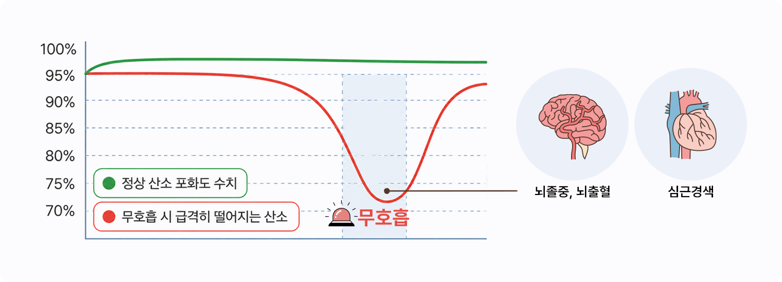 수면무호흡과 심혈관 질환 — 심근경색·부정맥·고혈압 위험 증가 그래프